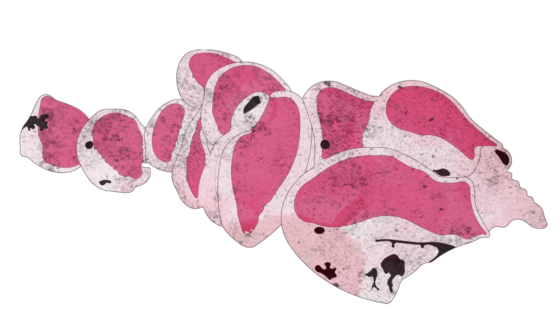 Magenta tissue section study of overlapping speckled chambers